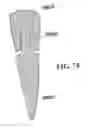 Fig. 53 - Methods of designing and manufacturing customized dental prosthesis for periodontal or osseointegration and related systems