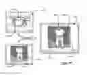 Fig. 56 - Methods of designing and manufacturing customized dental prosthesis for periodontal or osseointegration and related systems