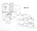 Fig. 58 - Methods of designing and manufacturing customized dental prosthesis for periodontal or osseointegration and related systems