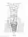 Fig. 05 - APPARATUS AND METHOD FOR ENDODONTIC TREATMENT