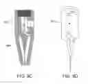 Fig. 14 - APPARATUS AND METHOD FOR ENDODONTIC TREATMENT