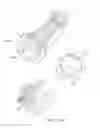 Fig. 16 - APPARATUS AND METHOD FOR ENDODONTIC TREATMENT
