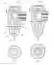 Fig. 32 - APPARATUS AND METHOD FOR ENDODONTIC TREATMENT