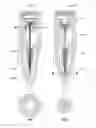 Fig. 33 - APPARATUS AND METHOD FOR ENDODONTIC TREATMENT