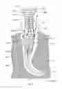 Fig. 49 - APPARATUS AND METHOD FOR ENDODONTIC TREATMENT