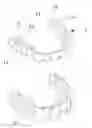 Fig. 01 - INVISIBLE PLASTIC TEETH BRACE FOR ORTHODONTICS