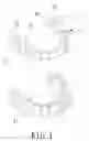 Fig. 02 - INVISIBLE PLASTIC TEETH BRACE FOR ORTHODONTICS