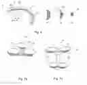 Fig. 06 - Orthodontic shape memory band