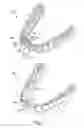 Fig. 02 - Treatment plan specific bite adjustment structures