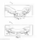 Fig. 06 - Treatment plan specific bite adjustment structures