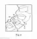 Fig. 07 - Treatment plan specific bite adjustment structures