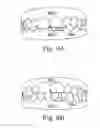 Fig. 10 - Treatment plan specific bite adjustment structures