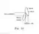 Fig. 11 - Treatment plan specific bite adjustment structures