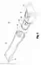 Fig. 06 - Intraoral scanner and computing system for capturing images and generating three-dimensional models
