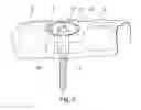 Fig. 03 - Measuring system and method for measuring an implant-implant situation