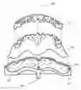 Fig. 01 - Oral device, manufacturing apparatus and methods of making the same