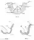 Fig. 02 - Oral device, manufacturing apparatus and methods of making the same