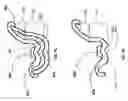 Fig. 06 - Oral device, manufacturing apparatus and methods of making the same