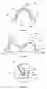 Fig. 10 - Oral device, manufacturing apparatus and methods of making the same