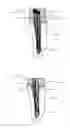 Fig. 05 - Reinforcing structure for coronal-radicular dental restoration, method for carrying out coronal-radicular dental restoration, and coronal-radicular restoration