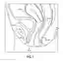 Fig. 02 - Intravaginal support devices and methods