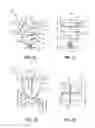 Fig. 18 - Intravaginal support devices and methods