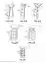 Fig. 20 - Intravaginal support devices and methods