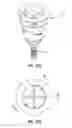 Fig. 29 - Intravaginal support devices and methods