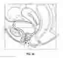 Fig. 63 - Intravaginal support devices and methods