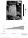 Fig. 12 - Device having a structured coating for the treatment of eardrum perforations
