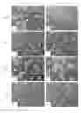 Fig. 13 - Device having a structured coating for the treatment of eardrum perforations