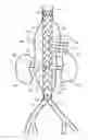 Fig. 01 - Vascular prosthesis with fenestration ring and methods of use