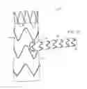 Fig. 08 - Vascular prosthesis with fenestration ring and methods of use