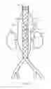 Fig. 09 - Vascular prosthesis with fenestration ring and methods of use