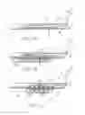 Fig. 04 - DEVICE FOR RAPID REPAIR OF BODY CONDUITS