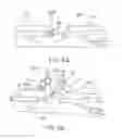 Fig. 10 - DEVICE FOR RAPID REPAIR OF BODY CONDUITS