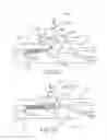 Fig. 11 - DEVICE FOR RAPID REPAIR OF BODY CONDUITS