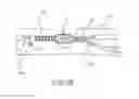 Fig. 12 - DEVICE FOR RAPID REPAIR OF BODY CONDUITS