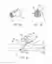 Fig. 17 - DEVICE FOR RAPID REPAIR OF BODY CONDUITS