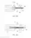 Fig. 25 - DEVICE FOR RAPID REPAIR OF BODY CONDUITS