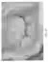 Fig. 05 - Device, system, and method for transcatheter treatment of valvular regurgitation