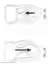 Fig. 06 - Device, system, and method for transcatheter treatment of valvular regurgitation