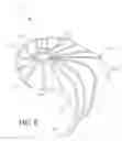 Fig. 15 - Device, system, and method for transcatheter treatment of valvular regurgitation