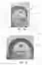 Fig. 18 - Device, system, and method for transcatheter treatment of valvular regurgitation