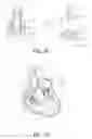 Fig. 26 - Device, system, and method for transcatheter treatment of valvular regurgitation