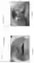 Fig. 33 - Device, system, and method for transcatheter treatment of valvular regurgitation