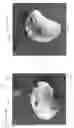 Fig. 40 - Device, system, and method for transcatheter treatment of valvular regurgitation
