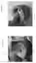 Fig. 43 - Device, system, and method for transcatheter treatment of valvular regurgitation
