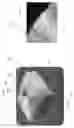 Fig. 44 - Device, system, and method for transcatheter treatment of valvular regurgitation