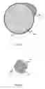 Fig. 02 - Devices for mitigating vessel leakage